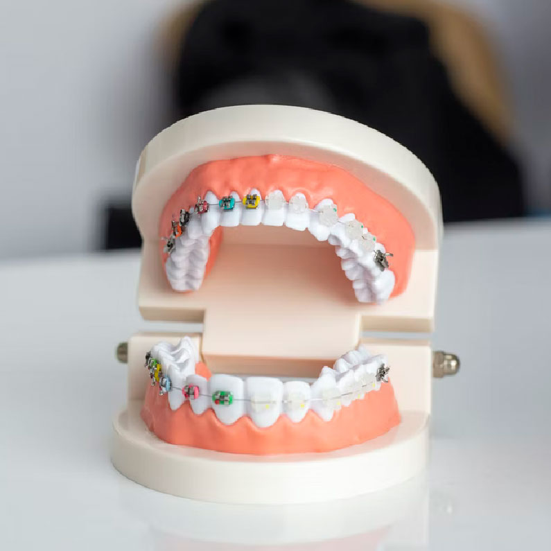 Orthodontic Services