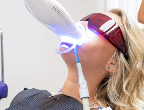 Is Teeth Whitening Safe? What to Know Before You Whiten Your Teeth