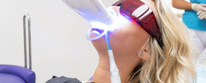 teeth whitening