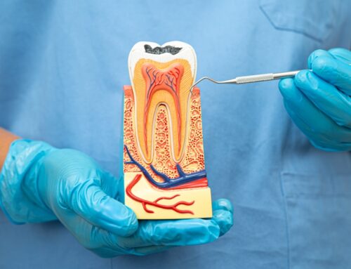 The Truth About Root Canals