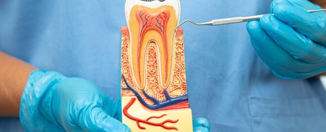 root canal treatment