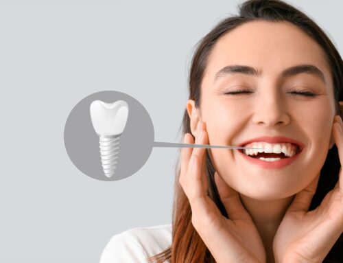 How To Care for Dental Implants