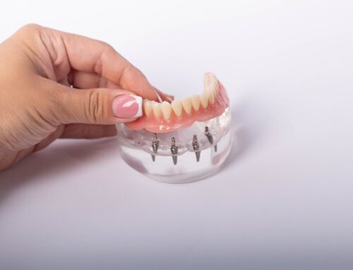 The Difference Between Dental Implants and Dentures